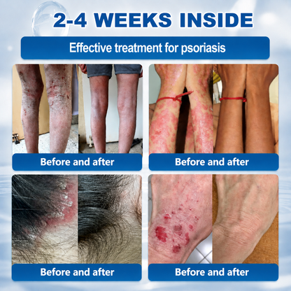 𝐇𝐞𝐚𝐥𝒓𝒊𝒛𝒆® 💃💃7-𝐃𝐚𝐲 𝐒𝐤𝐢𝐧 𝐓𝐚𝐠 & 𝐒𝐩𝐨𝐭 𝐄𝐫𝐚𝐬𝐞𝐫 𝐂𝐫𝐞𝐚𝐦 (Zero Pain, Zero 𝐒𝐜𝐚𝐫𝐬 Formula)