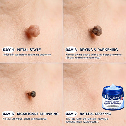 𝐇𝐞𝐚𝐥𝒓𝒊𝒛𝒆® 💃💃7-𝐃𝐚𝐲 𝐒𝐤𝐢𝐧 𝐓𝐚𝐠 & 𝐒𝐩𝐨𝐭 𝐄𝐫𝐚𝐬𝐞𝐫 𝐂𝐫𝐞𝐚𝐦 (Zero Pain, Zero 𝐒𝐜𝐚𝐫𝐬 Formula)